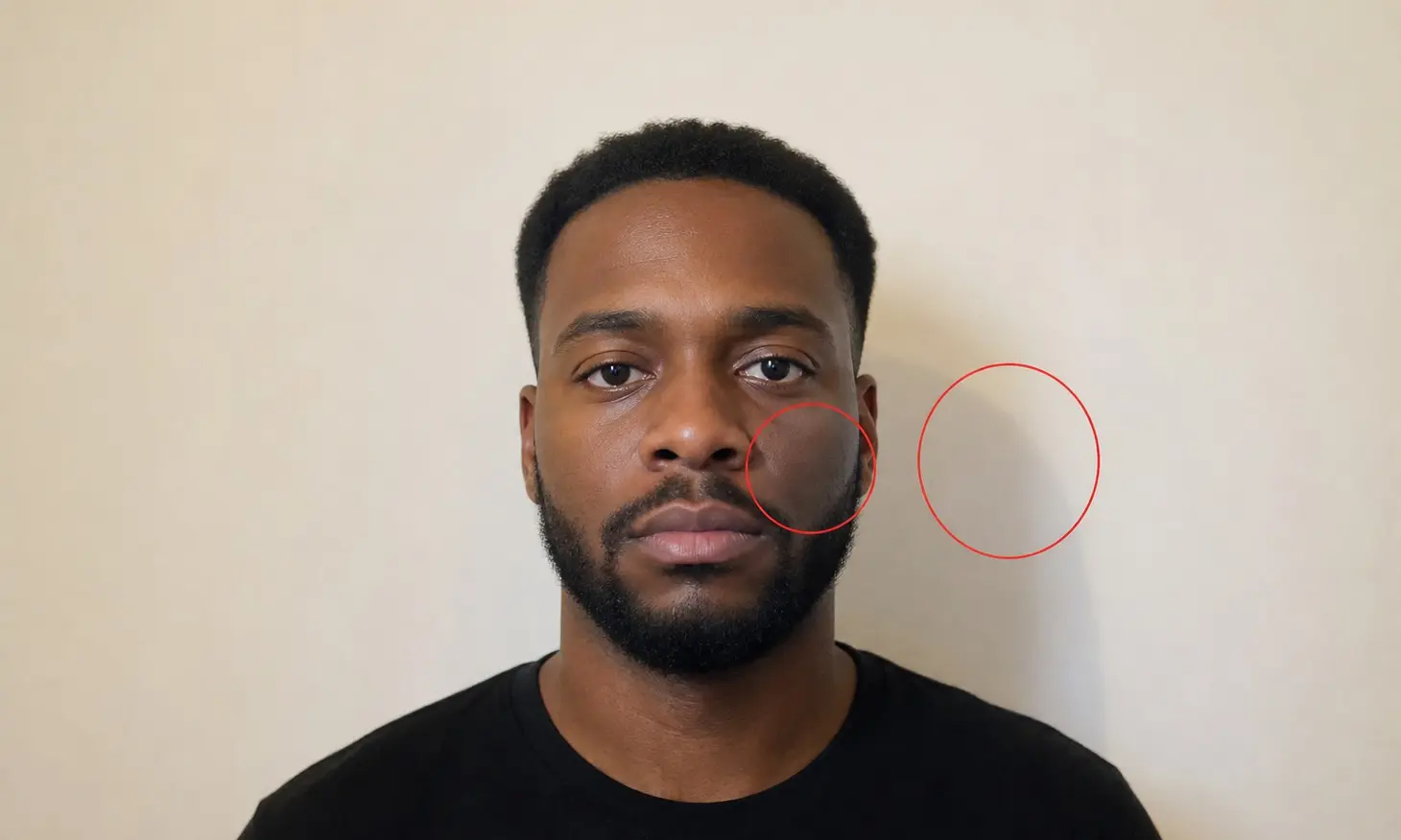 UK passport photo with red circles marking a shadow on one cheek and a shadow on the wall behind the head